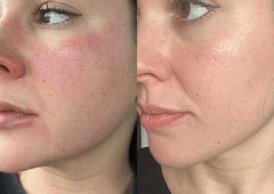 Before & After