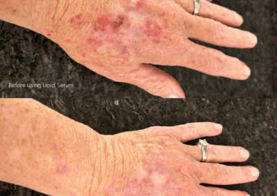 Hand Skin Results
