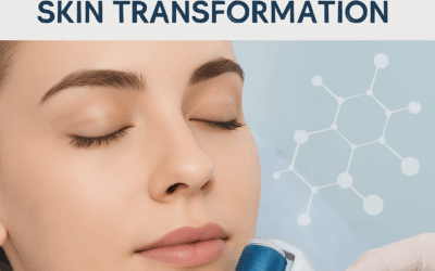 Microneedle Therapy: The Science Behind Skin Transformation